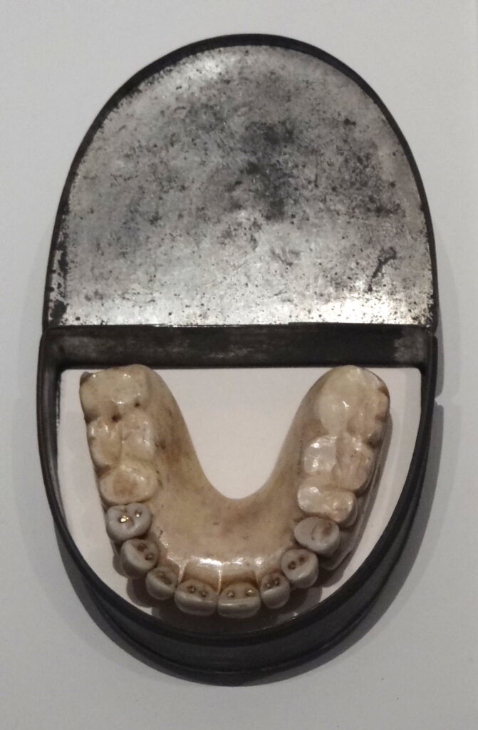 waterloo teeth dentistry dentures